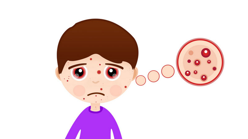 皮膚癌不是防癌險說的那種“癌”